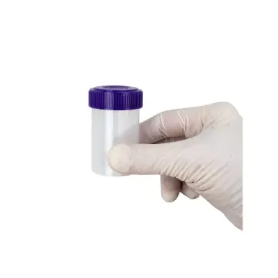 Picture of Specimen Container