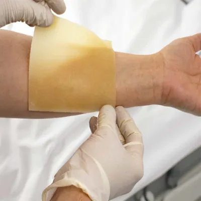 Picture of XeroBurn Sterile Burn Dressing